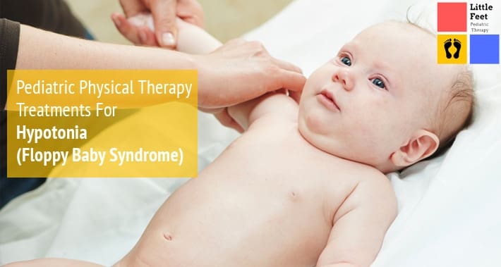 Patau syndrome physical characteristics