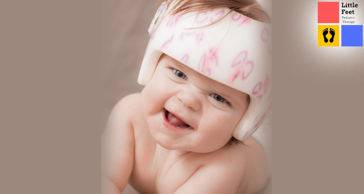 Do All Babies With Plagiocephaly Also Have Torticollis? | Little Feet Pediatric Occupational Therapy Pediatric Speech Therapy Clinic Washington DC, Charlotte NC, Raleigh NC, St Louis MO