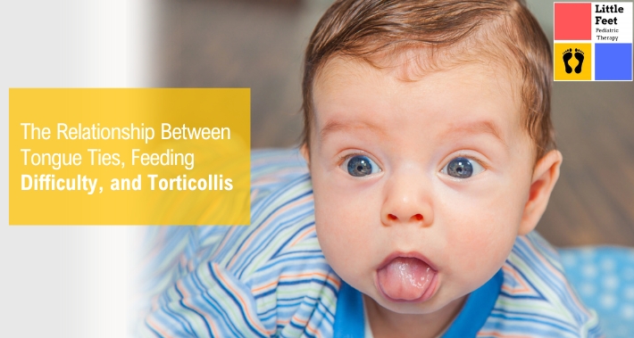 The Relationship Between Tongue Ties, Feeding Difficulty, and Torticollis | Little Feet Therapy | Pediatric Occupational Therapy Pediatric Physical Therapy Clinic | Washington DC, Charlotte NC, Raleigh NC, St Louis MO