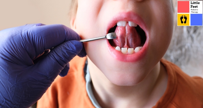 Pediatric Dentist For Mouth Breathing | Little Feet Therapy | Pediatric Occupational Therapy Pediatric Physical Therapy Clinic | Washington DC, Charlotte NC, Raleigh NC, St Louis MO